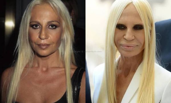 Biomédicos estetas participam do curso de especialização em Florianópolis-SC 8 Cirurgias plásticas bizarras