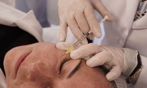 Paciente Modelo - Biomedicina Estética