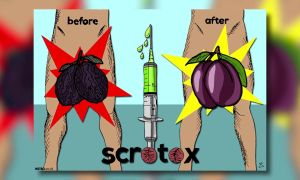 Scrotox- estética- masculina