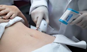 Estética: pesquisa garante que brasileiro considera cuidados estéticos uma necessidade