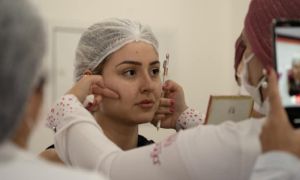 Harmonização Facial