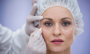 mitos sobre procedimentos no verão