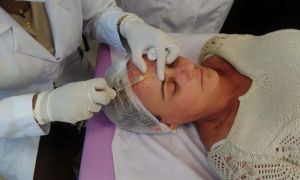 O que estimula a produção de colágeno? 10 dúvidas sobre o uso dos bioestimuladores 15 WhatsApp Image 2019 06 09 at 19.41.46 2ad9537b