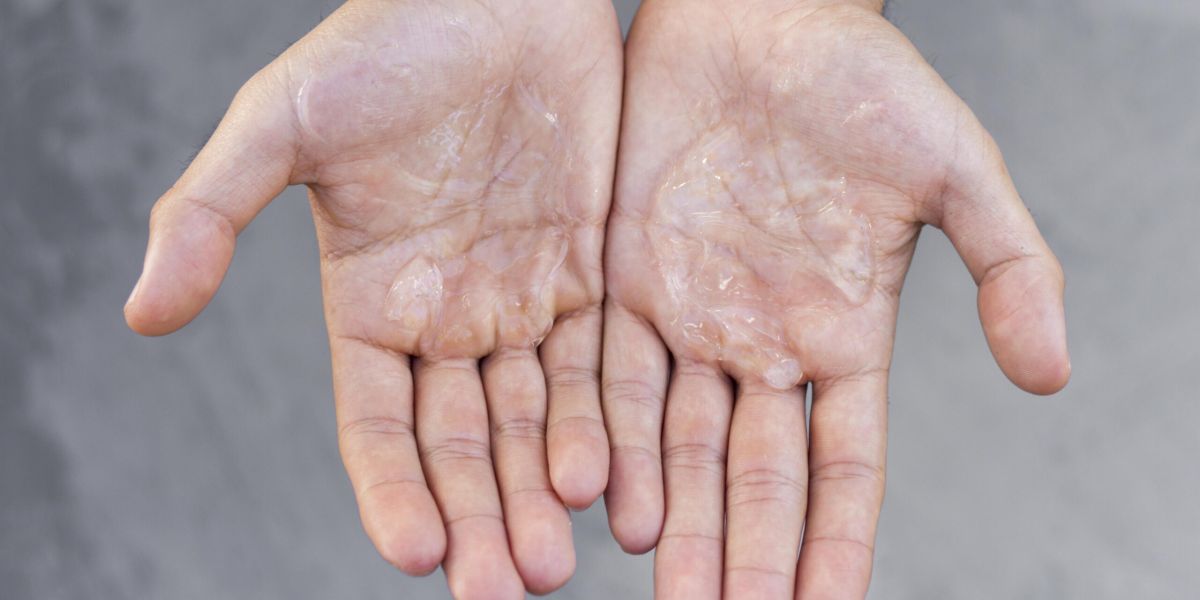 Toxina Botulínica no controle da Hiperidrose: o papel estratégico do Biomédico Esteta 1 Texto 3 scaled 2f5d150d