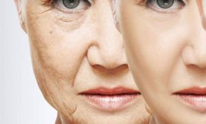 envelhecimento precoce