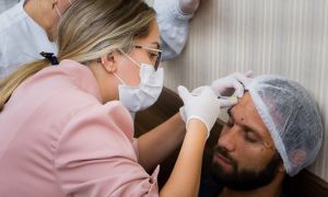 Vivencia clinica toxina botox paciante modelo 3 scaled 333de0fa