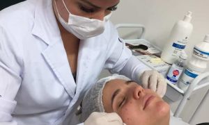 O que estimula a produção de colágeno? 10 dúvidas sobre o uso dos bioestimuladores 14 WhatsApp Image 2019 08 11 at 19.48.41 3f04d5fe