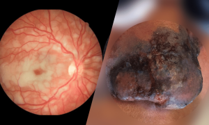 Biomédico Esteta não faz procedimentos cirúrgicos invasivos 19 dermatologista-cegueira-dentista-necrose