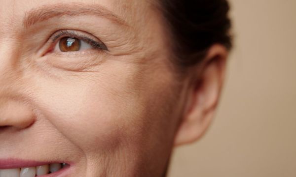 Biomédica esteta dá detalhes de como administra a blefaroplastia sem cortes em sua clínica 7 Tratamentos topicos para rugas dinamicas 5995cfdd