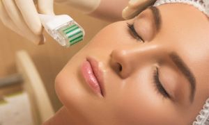 O que estimula a produção de colágeno? 10 dúvidas sobre o uso dos bioestimuladores 9 microagulhamento
