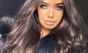 Biomédico Esteta não faz procedimentos cirúrgicos invasivos 16 blogueira labios inchados 668819bf