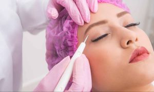 jato-plasma-procedimento