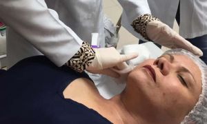 Saiba como denunciar uma IES irregular no MEC e PROCON 18 peelings na pós-graduação