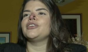 Priscilla Aguiar - Rinomodelação