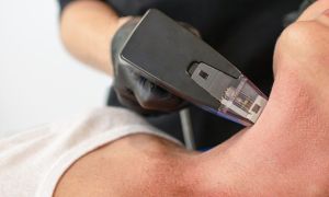 Morpheus o novo queridinho da estetica e uma oportunidade lucrativa 7448a383