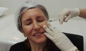 Toxina Botulínica e Botox