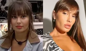 Harmonização Facial - Thais Braz