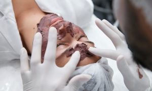 Conheça as vantagens da aplicação de peelings em sua clínica de estética