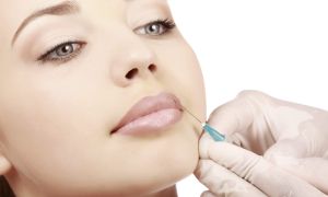 Os Procedimentos Aplicados pela Biomedicina Estética para Redução de Gordura Localizada 9 botox dentista 8b1cb50f