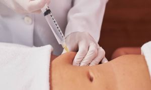 hidrolipoclasia procedimento biomedico 9abe5903