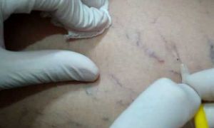 Biomédico Esteta - História de Sucesso Profissional 12 micro 9f4bdd56