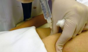 IV JORNADA DE BIOMEDICINA DA FACULDADE MARIO SCHENBERG 7 intradermoterapia biomedicina estetica a6e564b4