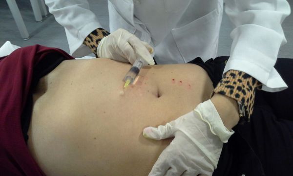 Curso de intradermoterapia