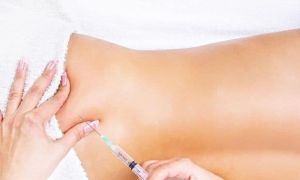 Palestra sobre Desintoxicação na Biomedicina Estética será um dos temas do 3º Congresso Brasileiro de Biomedicina Estética 6 mesoterapia de7c39b3