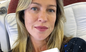 luana piovani procedimentos estéticos