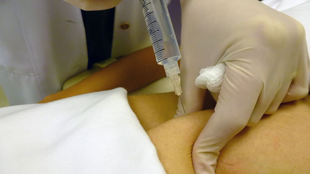 Toxina Botulínica e Intradermoterapia na Biomedicina Estética