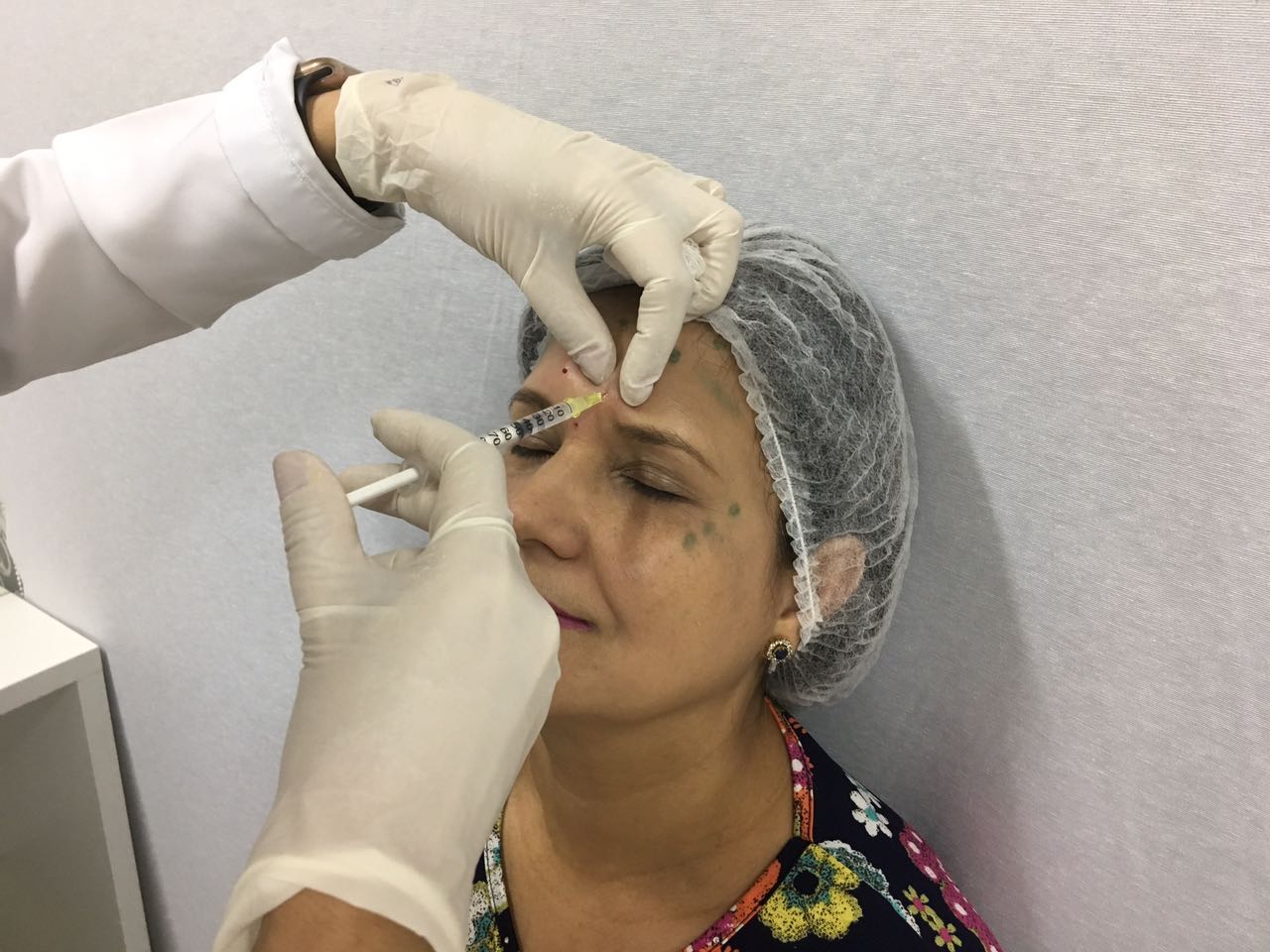 Curso de toxina botulínica traz retorno garantido para biomédico esteta