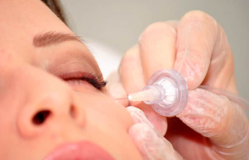 Carboxiterapia: técnica indispensável para sua clínica de estética e seu currículo