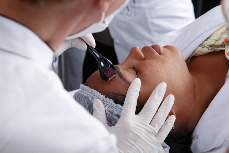 Curso de Microagulhamento tem curta duração e retorno garantido ao profissional esteta