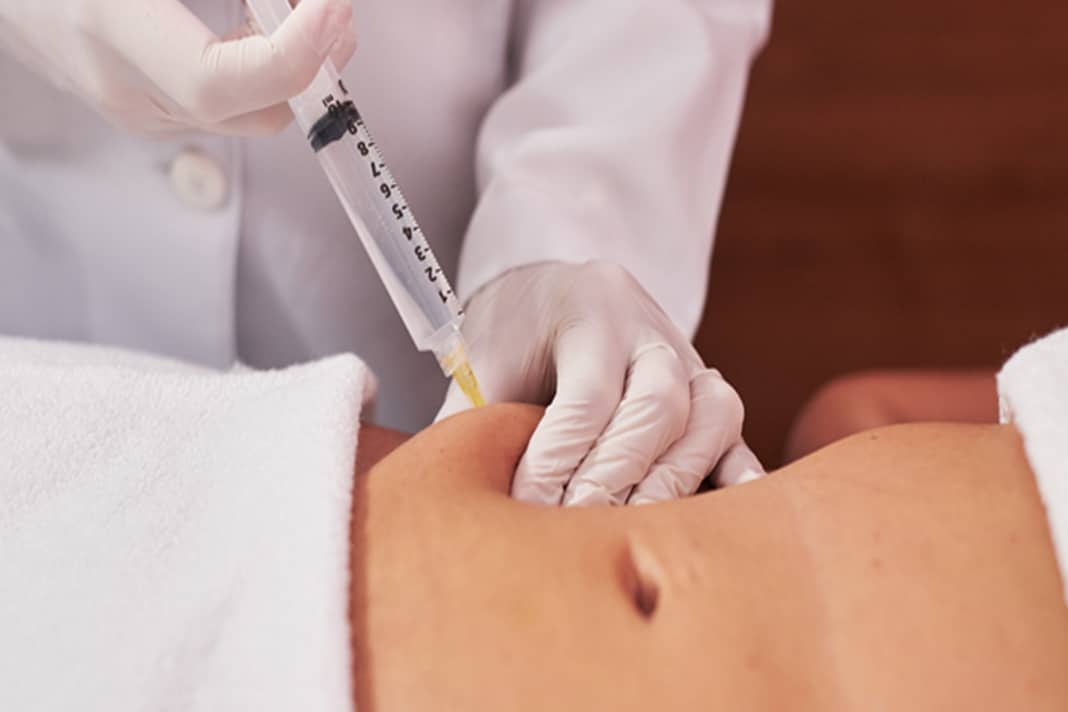 Hidrolipoclasia: conheça o tratamento contra as gordurinhas