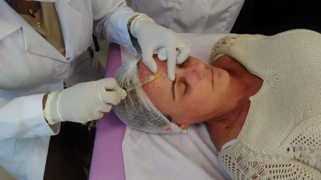 Curso de intradermoterapia para biomédico – Como funciona, técnica e faturamento