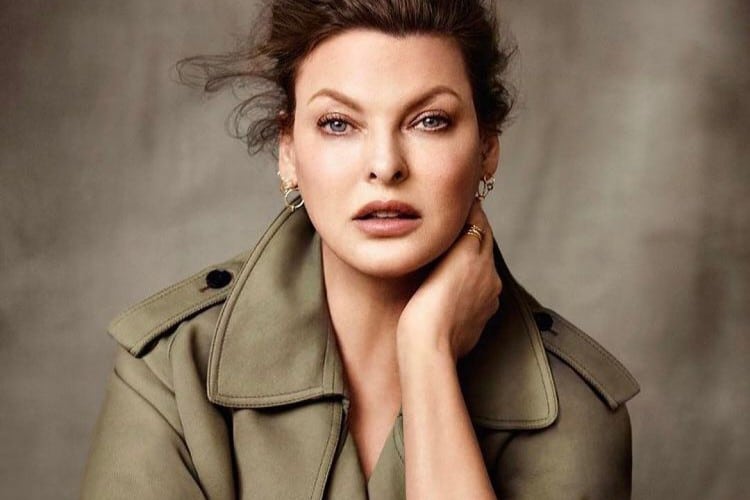 Modelo Linda Evangelista ‘desfigurada’ por erro em procedimento estético