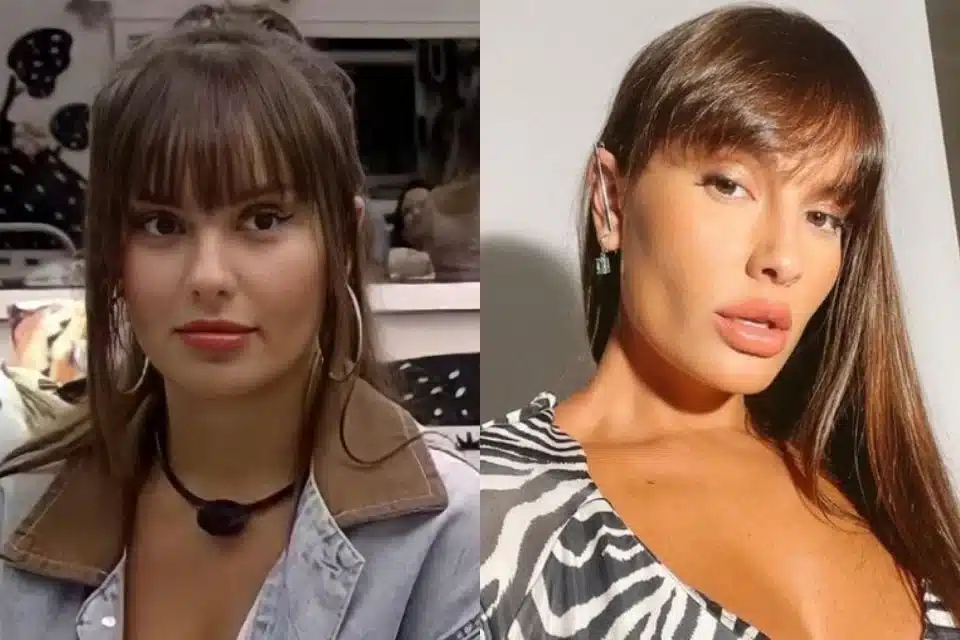 Suposta Harmonização Facial da ex-BBB Thais Braz gera polêmica