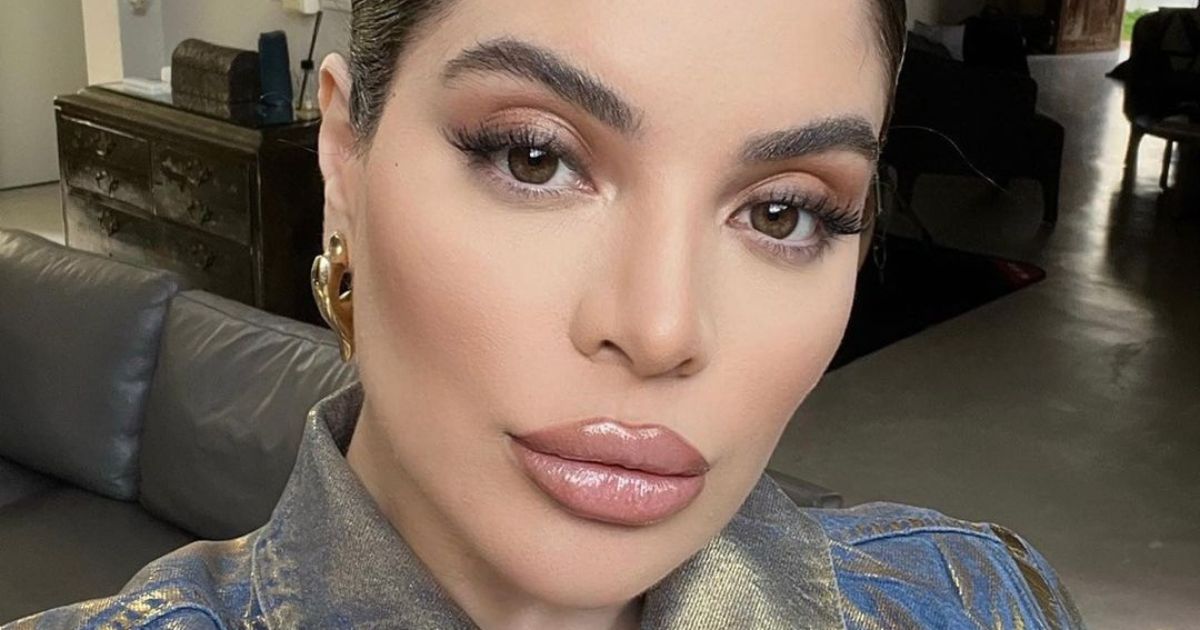 Arrependidos da Harmonização Facial? Famosos Buscam Reverter Procedimentos