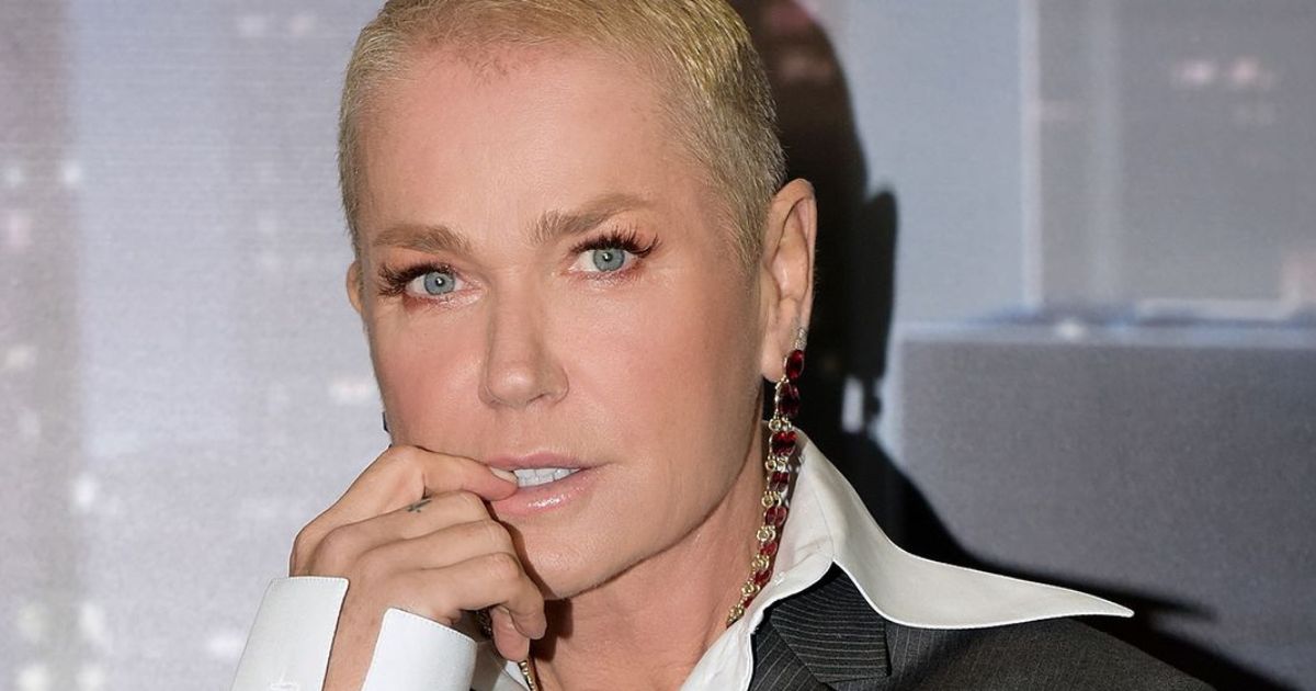 Xuxa realiza 80 Intervenções em 7 horas – entenda detalhes do tratamento