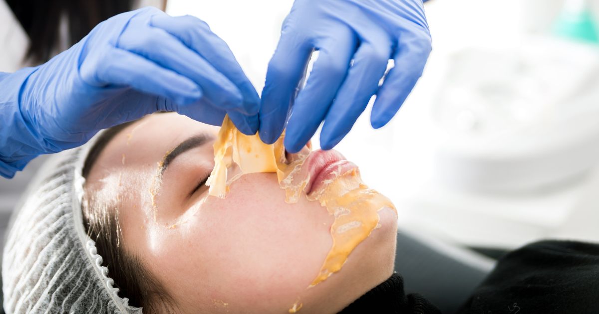 Mídia e CFM se aproveitam de polêmicas envolvendo peeling de fenol a fim de descredibilizar estetas