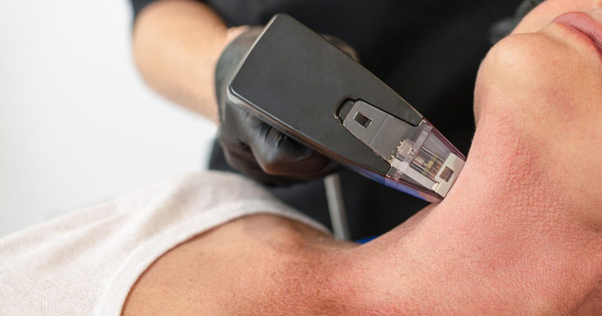 Morpheus: o novo queridinho da estética e uma oportunidade lucrativa