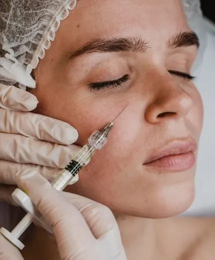 Bioestimuladores de colágeno: quando indicar e como planejar protocolos na Biomedicina Estética